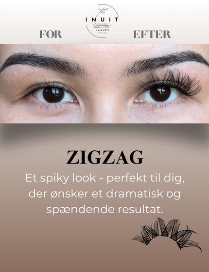 Zigzag/Volumen vipper