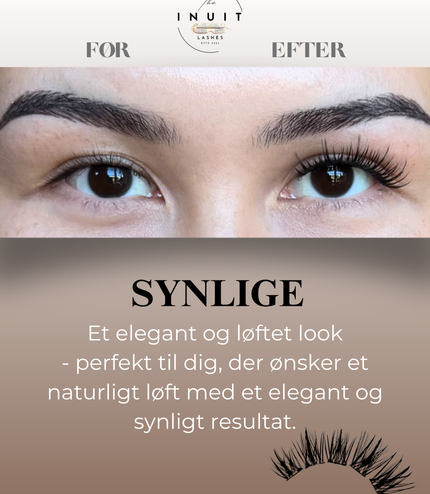 Synlige/Klassiske vipper