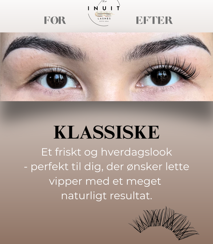 Synlige/Klassiske vipper
